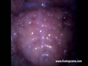 Girl Cums Filmed From Inside A Vagina At 