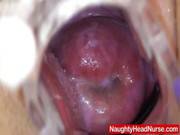 Speculum In A Tight Madam Medic Pussy