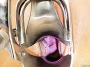 Gaped Vagina Of Hot Tempered Granny Simira Gets Stretched With Speculum