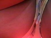 Upskirt King Special