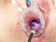 Dirty Happy Slut Magda Gets Her Pussy Stretched With Vaginal Speculum