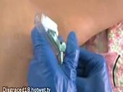 Speculum Bondage Teen