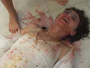 Brazillian Puke 1