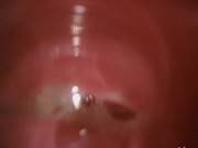 Extreme Korean Anal Hairy Sex
