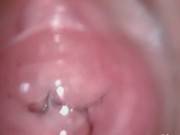 Extreme Japanese Anal Hairy Penetrate