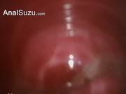 Extreme Japanese Anus Hairy Sex