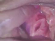 Hot Milf Amateur Big Cunt And Peehole