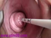 Extreme Real Cervix Fucking Insertion Japanese Sounds And Objects In Uterus