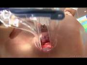 Anal Asshole Extreme Open