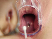 Jarmila Examination Video/jarmila. Part 2