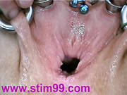 Insertion Semen Cum In Cervix Wide Stretching Pussy Speculum