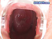 Frisky Brunette Gapes Her Pussy With Transparent Medical Tool