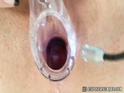 Nurse Adriana Stretching Pussy Wide With 