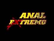 Anal Extremo Full Brazilian Movie Mks
7900