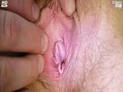 Tina Gyno Pussy Speculum Examination At Kinky Gyno Clin
518